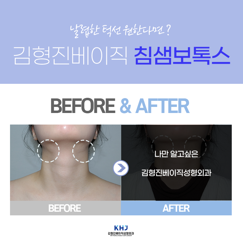 침샘치료도 역시 김형진베이직! 관련 이미지 5