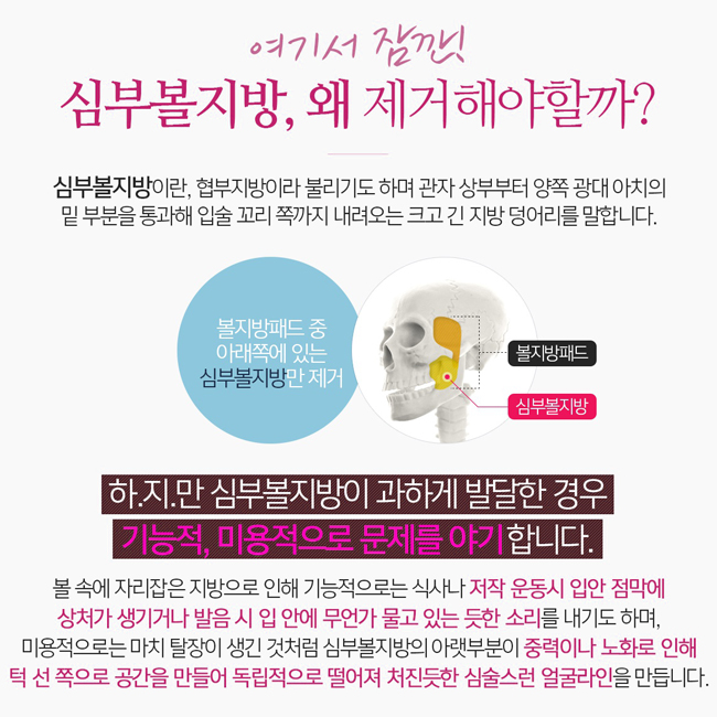 승무원성형외과에서 포샵 필요없는 얼굴라인으로~ 관련 이미지 2