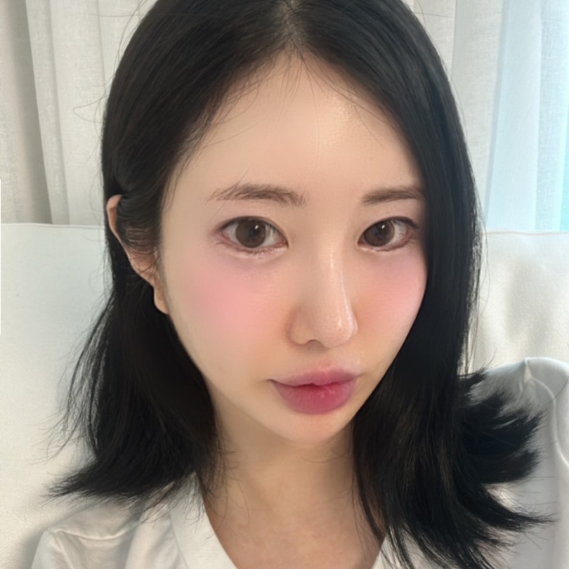 심부볼제거수술 덕분에 윤곽 필요 없어졌어요 관련 이미지 2