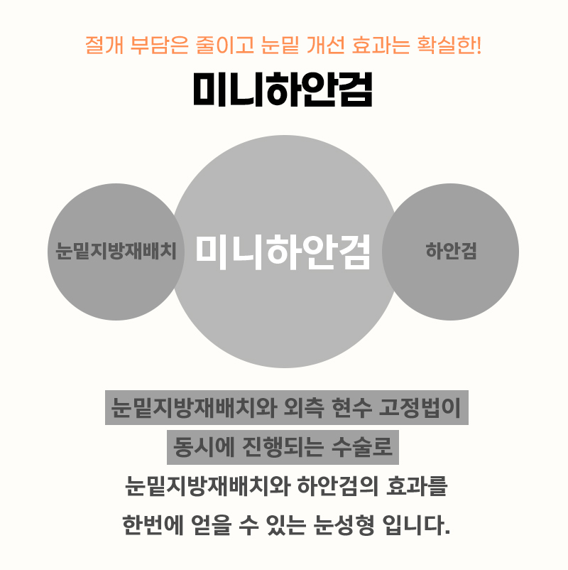 중년눈수술후기 진짜 어쩌면 좋죠? 관련 이미지 3