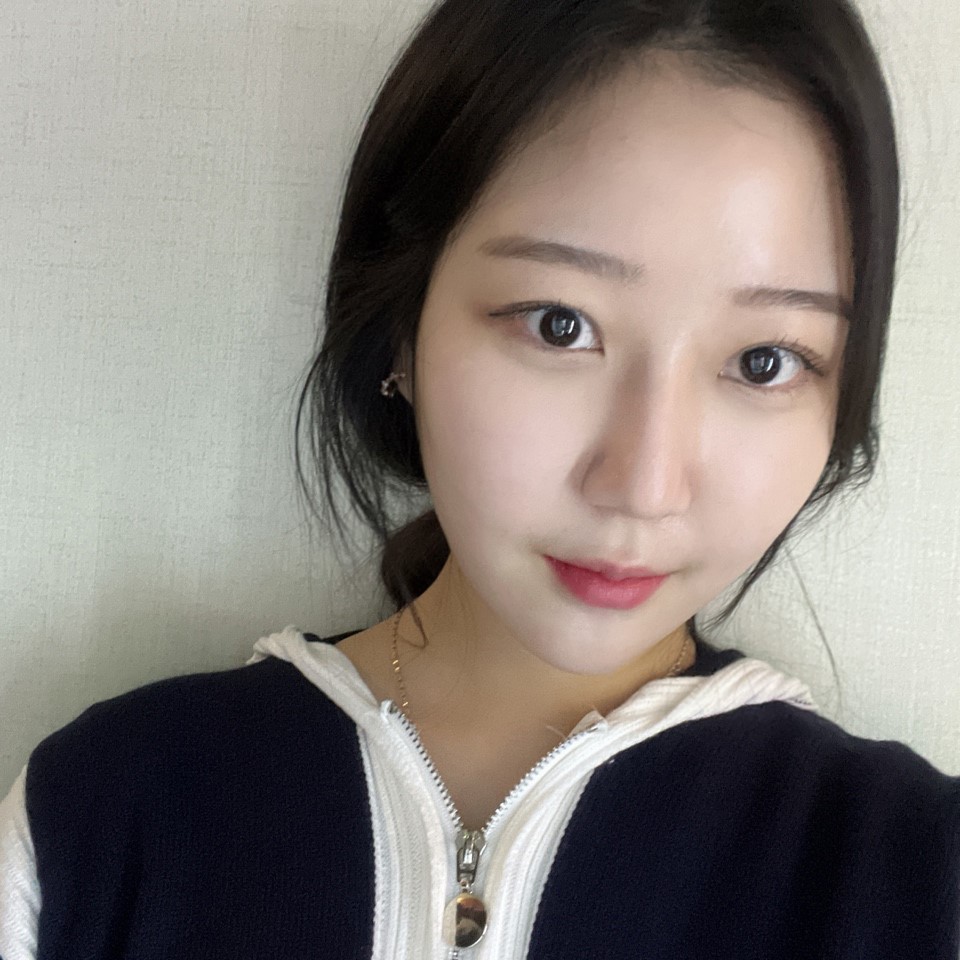 After Gangnam Under-Eye Fat Repositioning, It Looks Like the Under-Eye Fat Was Erased with an Eraserㅠㅠ image 2