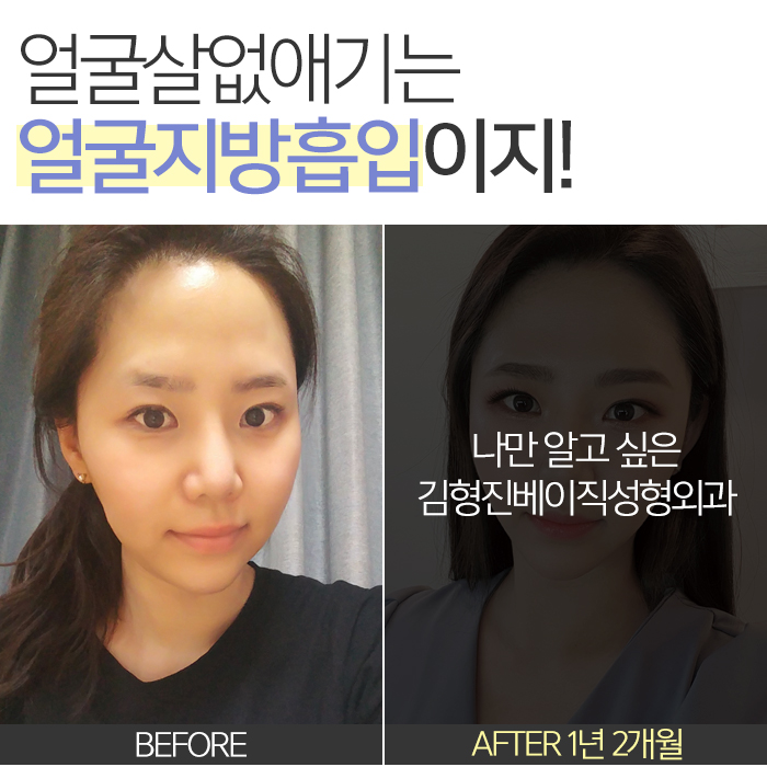 얼굴살없애기 이걸 몰랐단 말이야? 관련 이미지 2