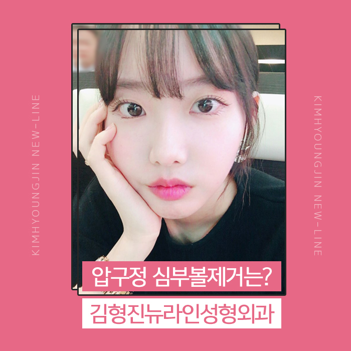 압구정심부볼제거 남다른 후기 관련 이미지 1
