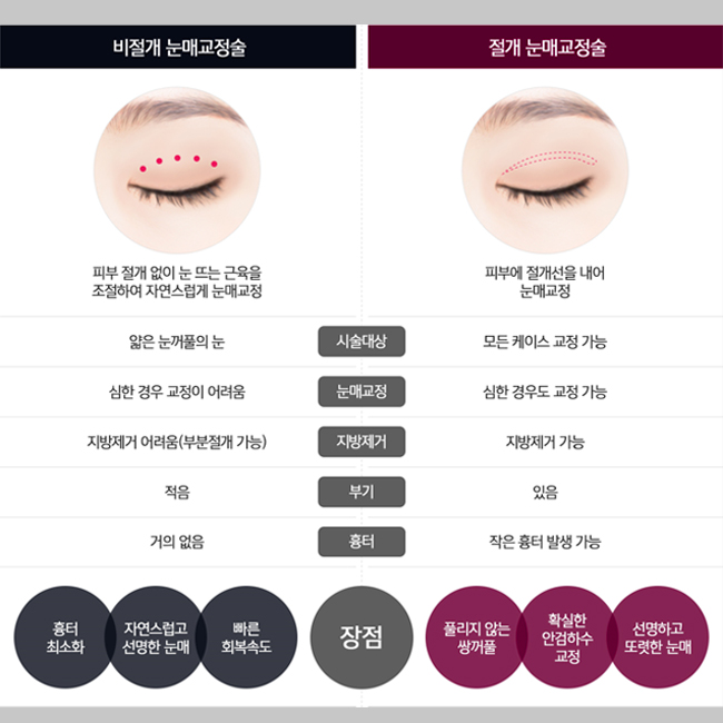 비절개눈매교정술 vs 절개눈매교정술 맞춤 눈 완성 관련 이미지 2