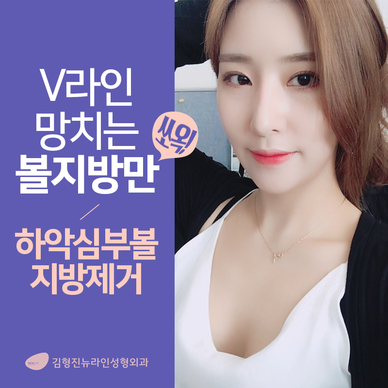 심부볼잘하는곳 이거레알 반박불가 관련 이미지 1