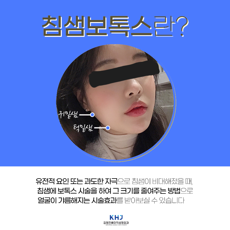 침샘시술전후 실력 좋은 곳에서 관련 이미지 3
