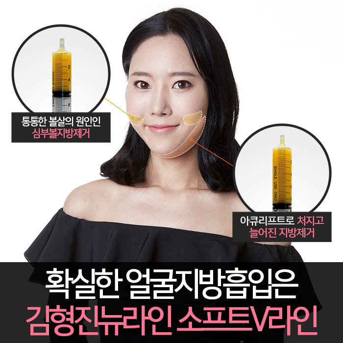 압구정얼굴지방흡입 잘한다고 했죠? 관련 이미지 4