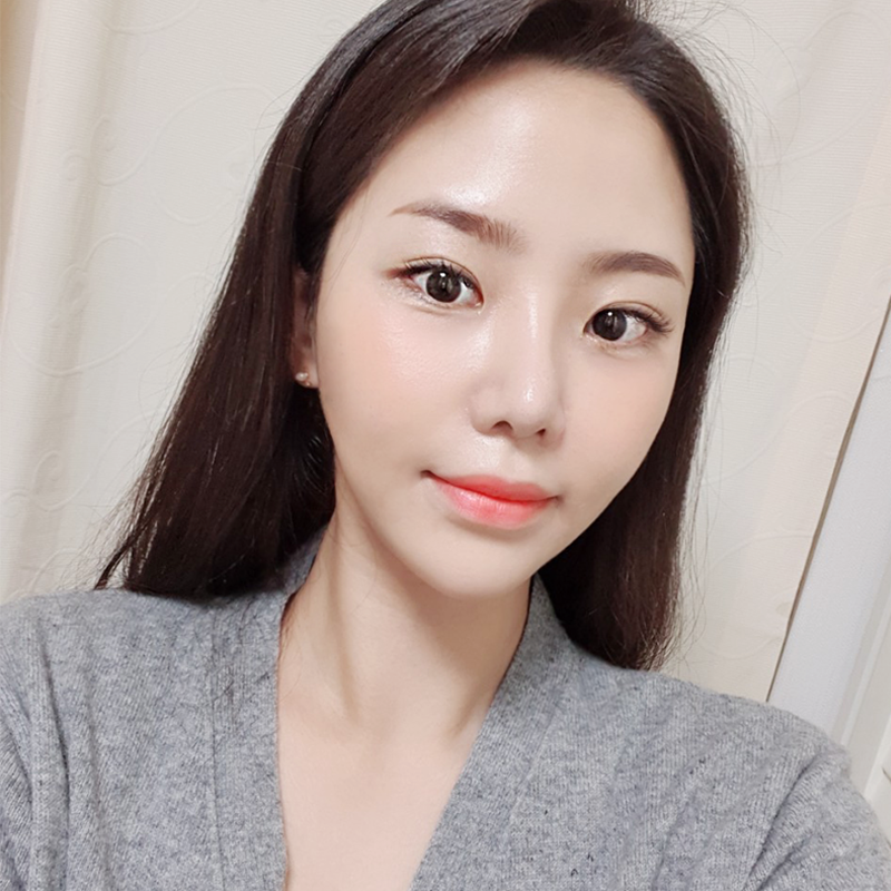 얼굴지방흡입방법 궁금하셨다면 관련 이미지 2