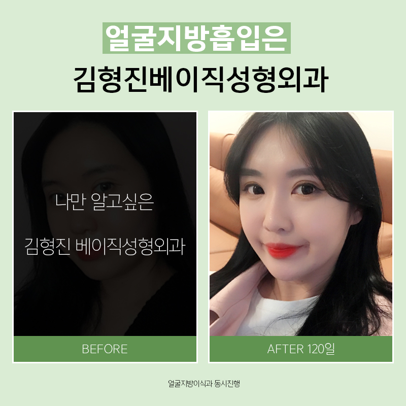 갸름한얼굴라인만드는법 쉬워요! 관련 이미지 6