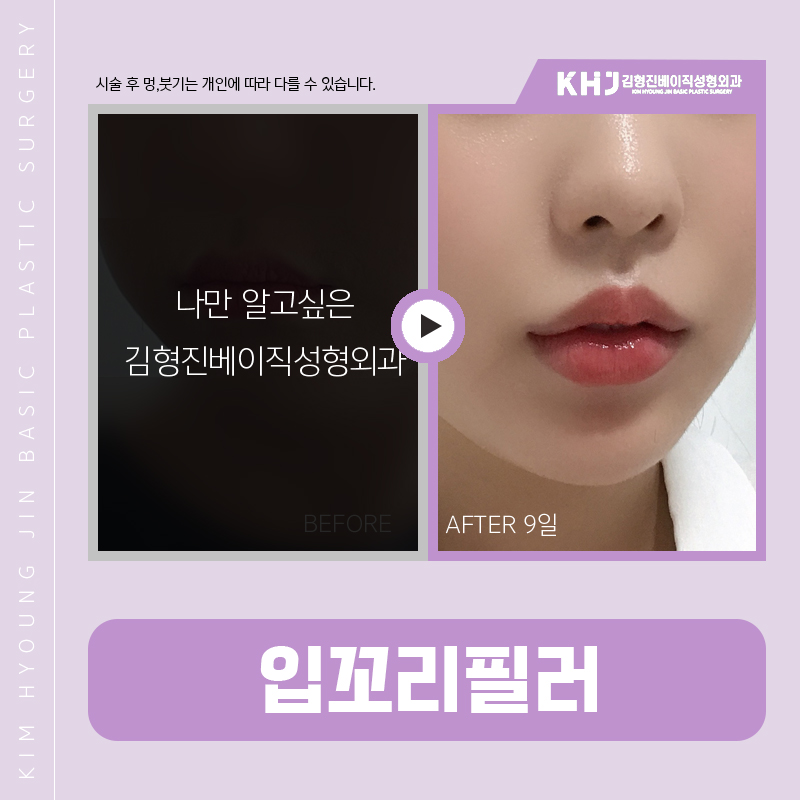 입꼬리올리는방법 진짜 알려드릴까요? 관련 이미지 8