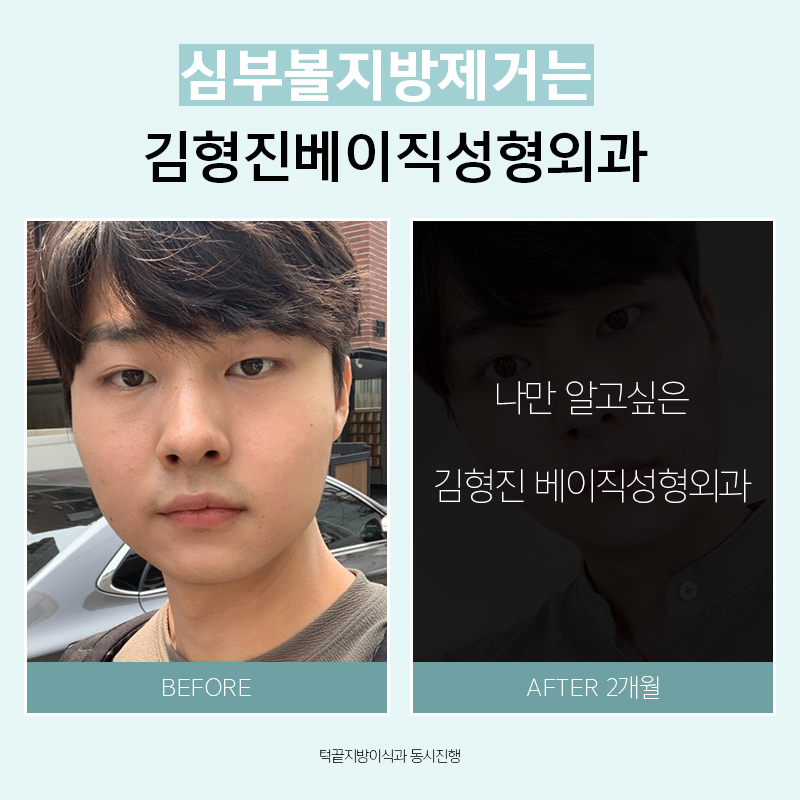 왜 하악심부볼이냐면요. 관련 이미지 6