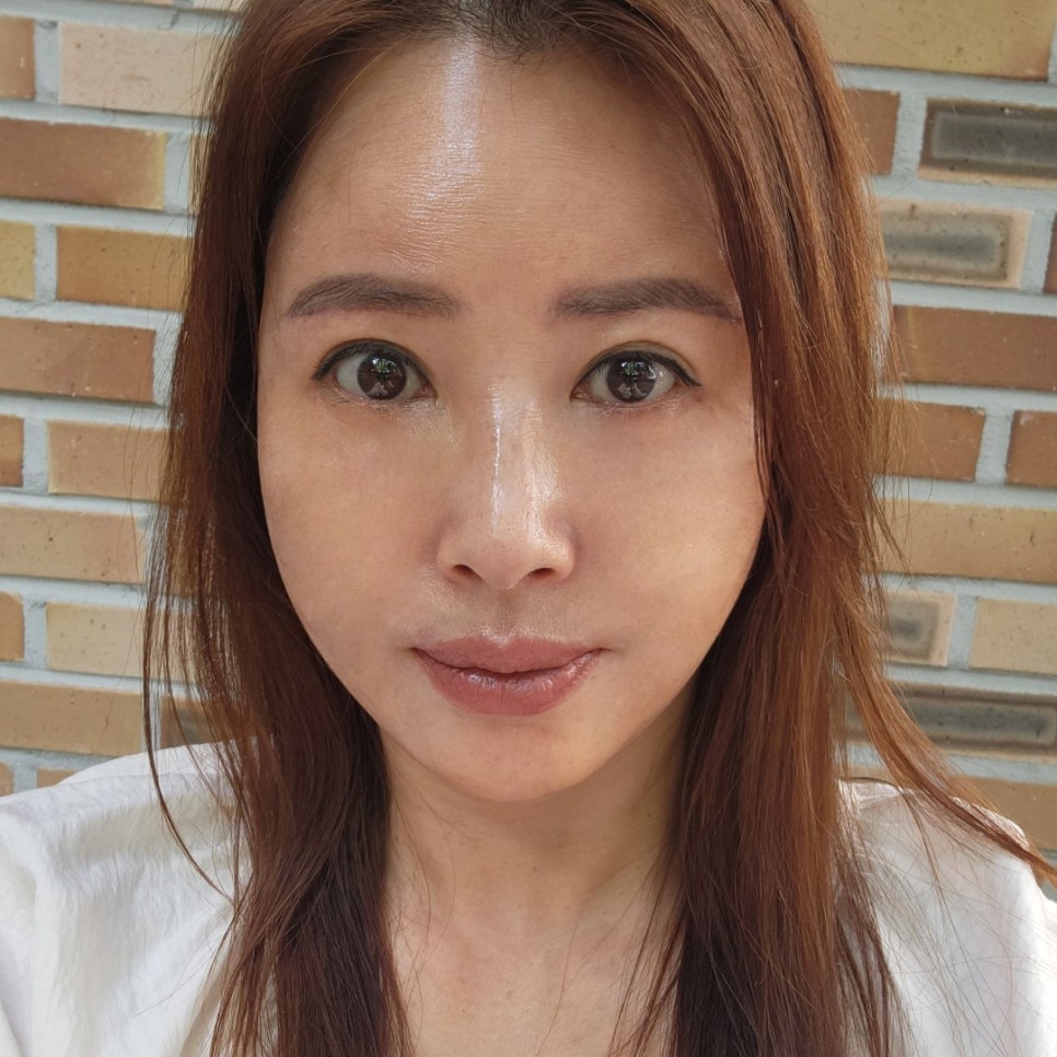 혹시 미니하안검비용 때문에 망설이고 계셨다면 관련 이미지 2