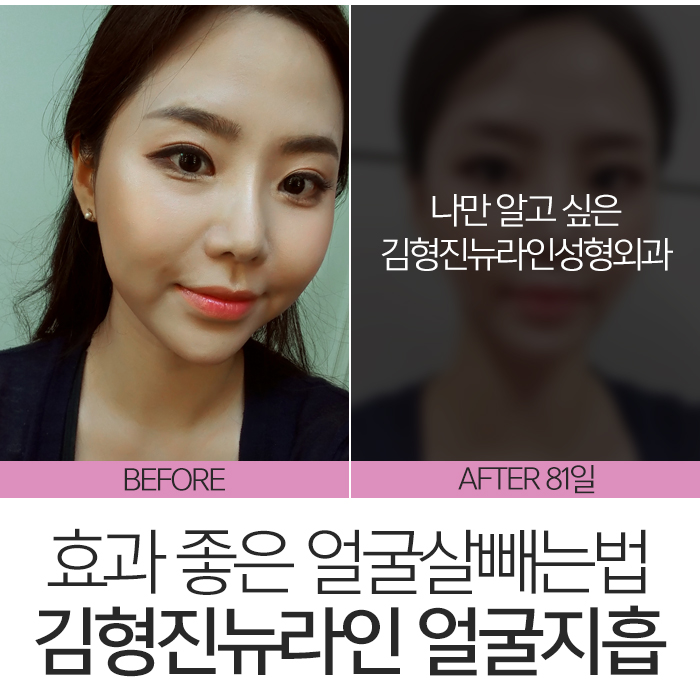 얼굴살빼는법 알아보고 있었다면? 관련 이미지 2