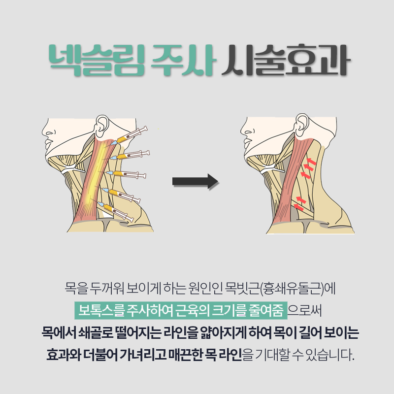 압구정넥슬림주사의 원조는 김형진베이직 뿐입니다 관련 이미지 4