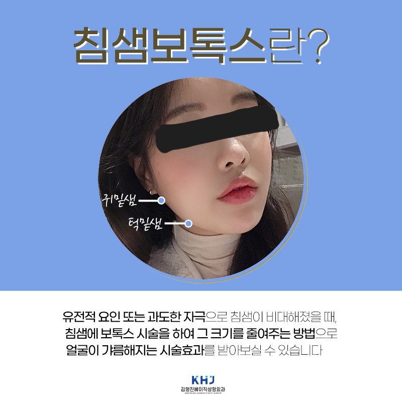 침샘비대증 때문에 고민이었다면 관련 이미지 3