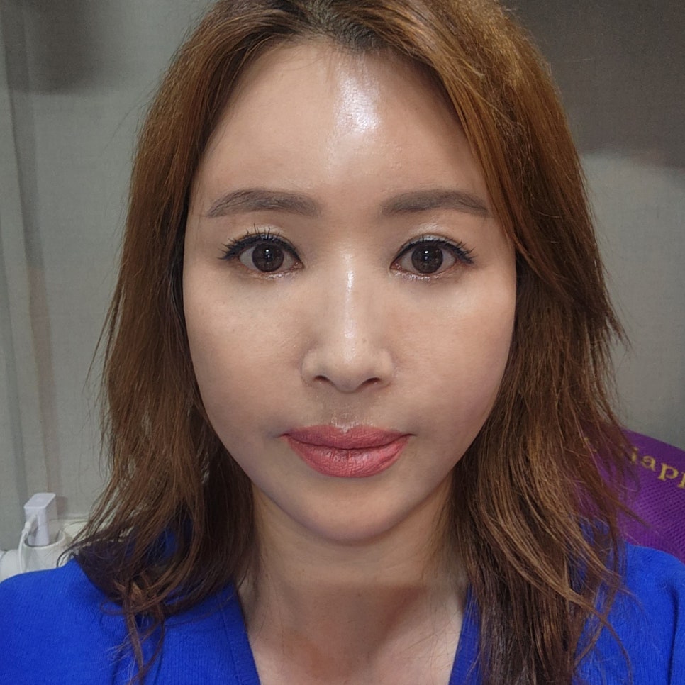 압구정하안검 김형진베이직에서 미니하안검으로 가볍게 해결해요! 관련 이미지 1