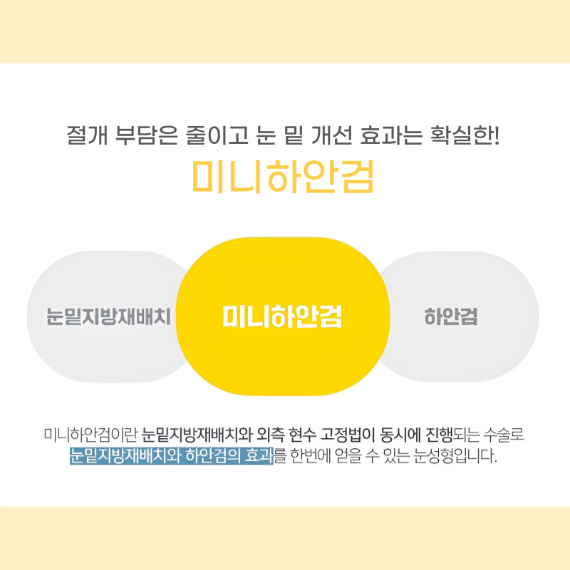 나이들어 보이는 눈, 중년눈수술 미니하안검으로 되돌려요 관련 이미지 3