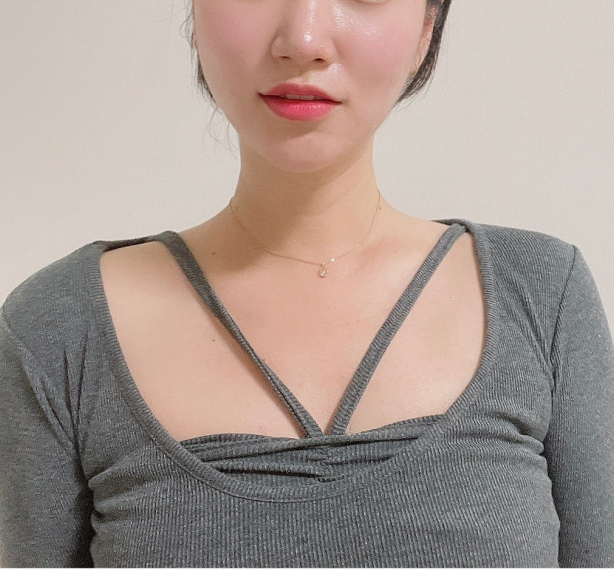 모르면 손해인 웨딩시술, 이것부터 하세요! 관련 이미지 4