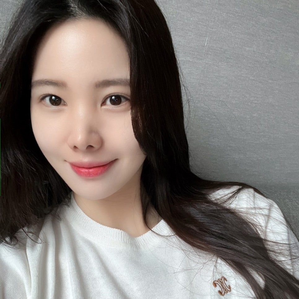 얼굴지방흡입전후 얼굴선이 또렷해지는 이유 관련 이미지 3