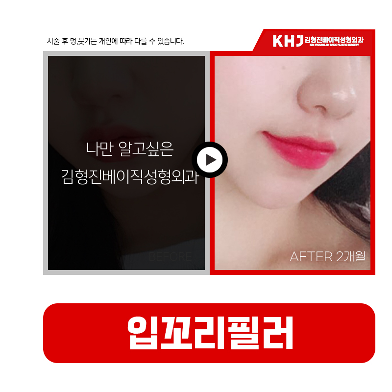 인상을 결정하는 핵심, 입꼬리올리는법 관련 이미지 6