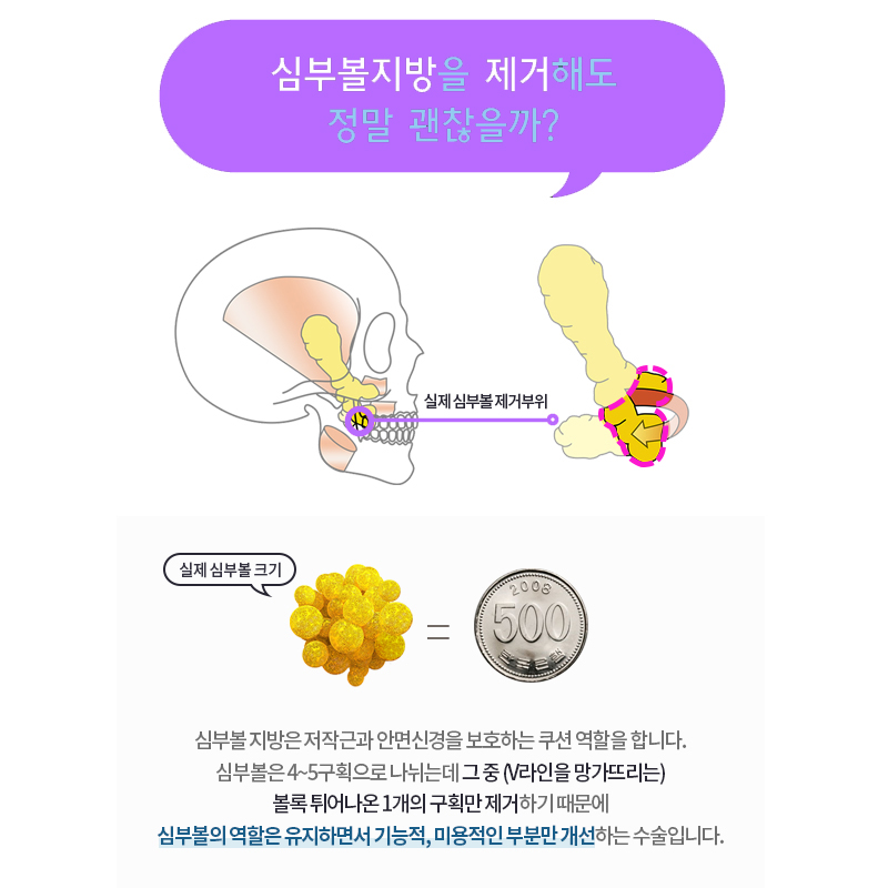 볼살제거수술 이거 하나면 확 달라집니다! 관련 이미지 5