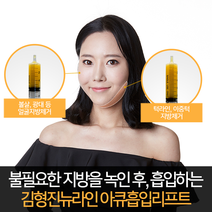 이중턱지방흡입후기 솔직하게 관련 이미지 5