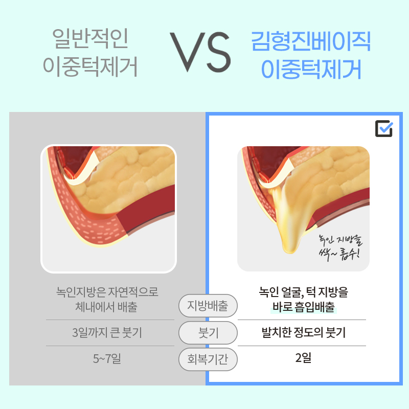 얼굴지방제거로 완벽한 얼굴형 완성하세요! 관련 이미지 5