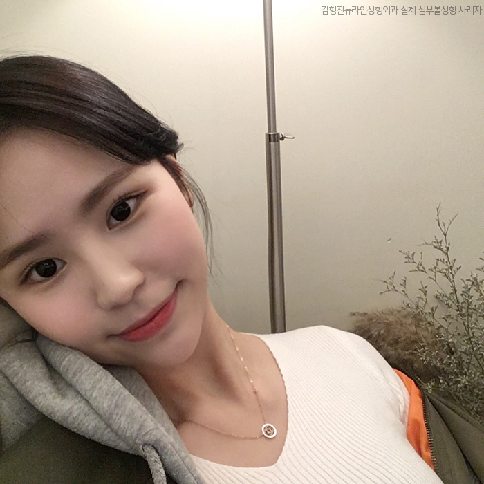 심부볼성형 능력자 김형진원장님! 관련 이미지 1