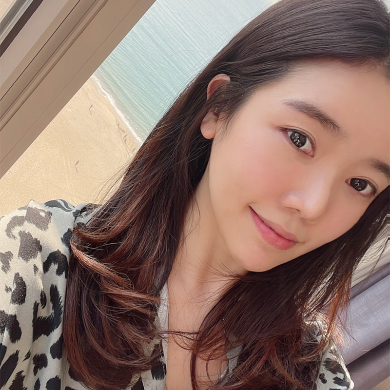 눈밑지방재배치회복기간 빠를 수밖에 없는 이유! 관련 이미지 1