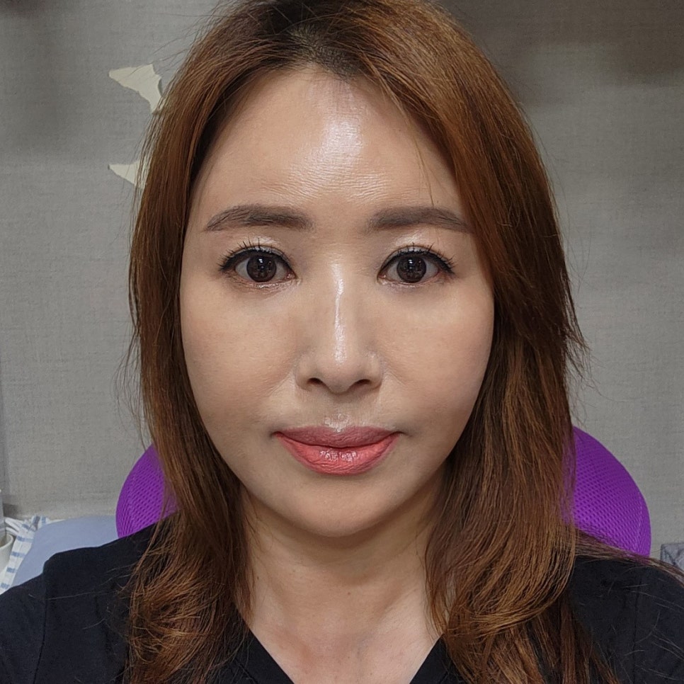 중년눈수술병원 어느 병원이 좋을지 모르겠다면 관련 이미지 2