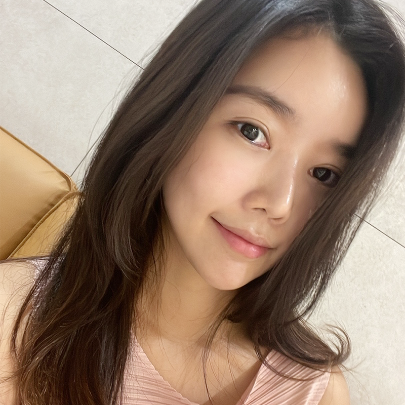 눈밑지방재배치유지력 오래가는 수술방법 찾으셨다면! 관련 이미지 1