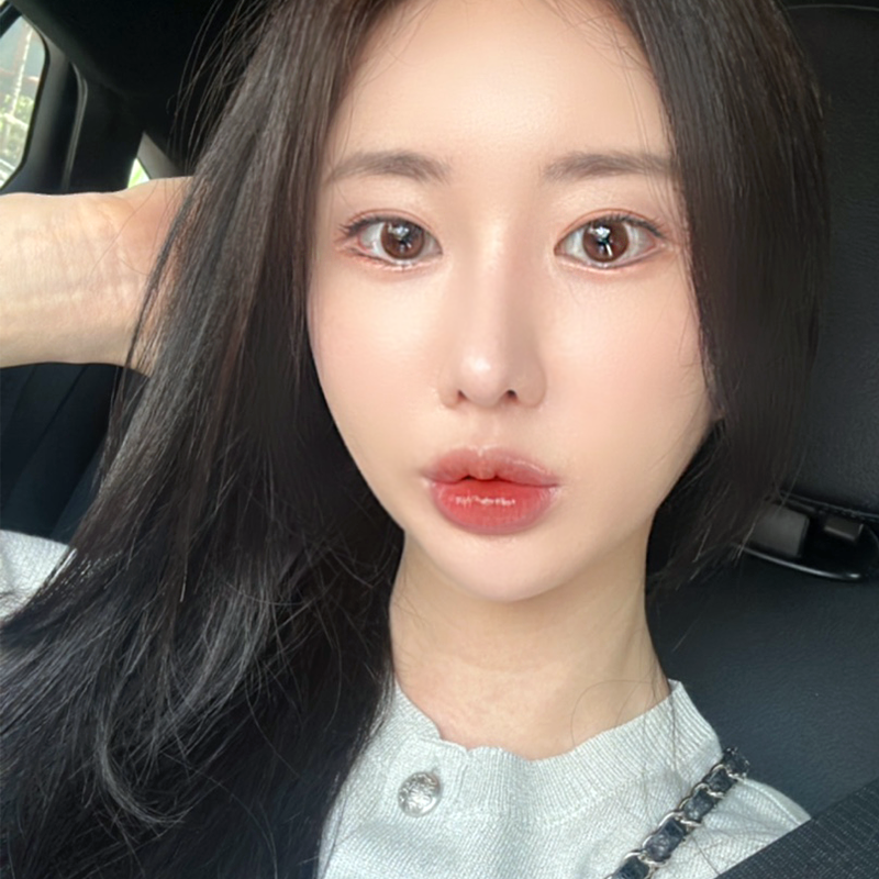 눈밑지방재배치수술 어떻게 진행되냐구요? 관련 이미지 1