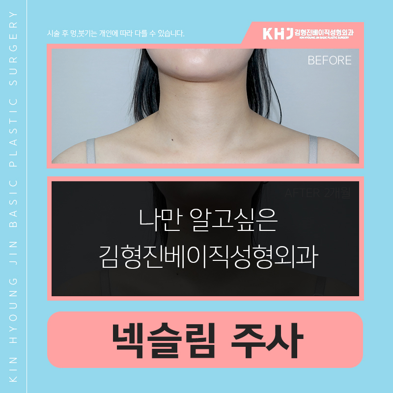 넥슬림주사후기 궁금하시죠? 관련 이미지 5