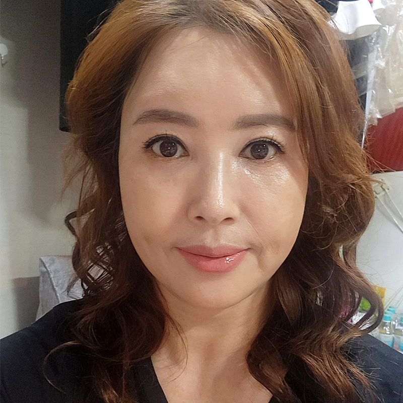 중년눈밑처짐 걱정하지 마세요! 관련 이미지 1