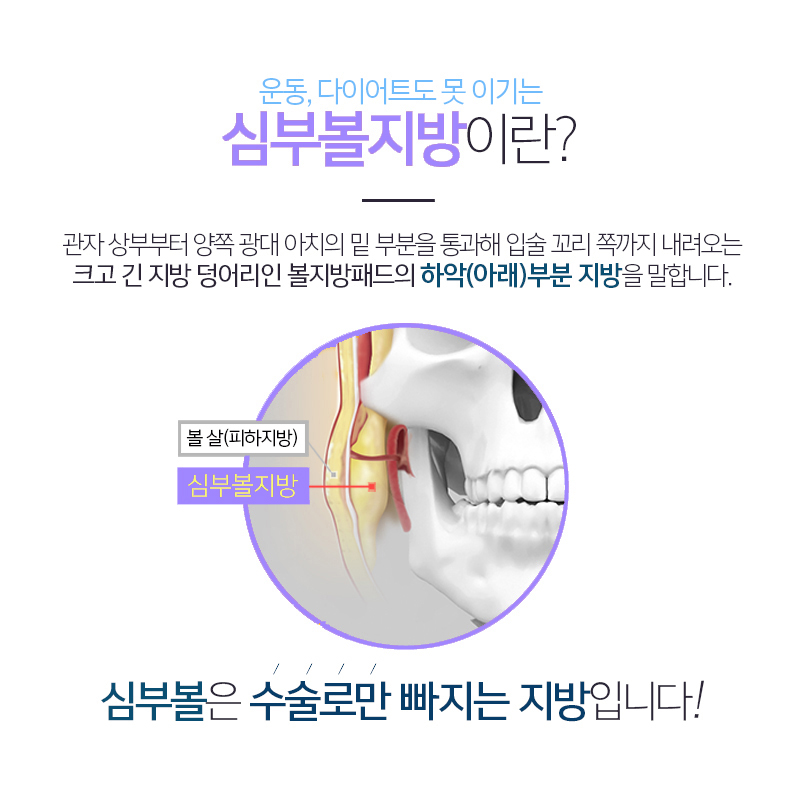 무겁고 처진 인상, 심부볼제거술로 해결해요 관련 이미지 3
