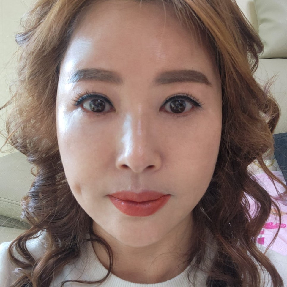 At a Clinic That Performs Even Mini Lower Blepharoplasty Incisions With Precision image 2