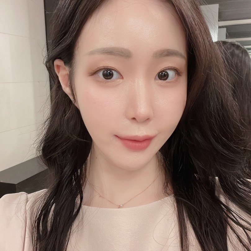 볼살없애는방법 덕분에 인생 리즈 찍었어요ㅠㅠ 관련 이미지 2