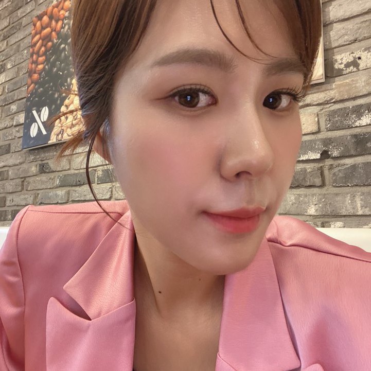 신사눈밑지 애교살 밑으로 접히는 눈 밑 지방 해결했어요 관련 이미지 1