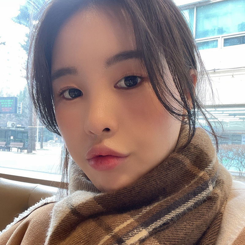 입꼬리필러붓기 별 거 아니죠! 관련 이미지 4