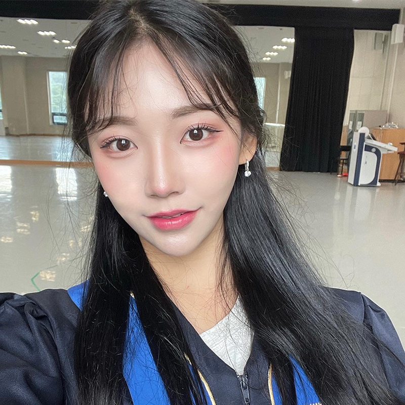 입꼬리필러후기 보고싶으신분 모여라! 관련 이미지 5