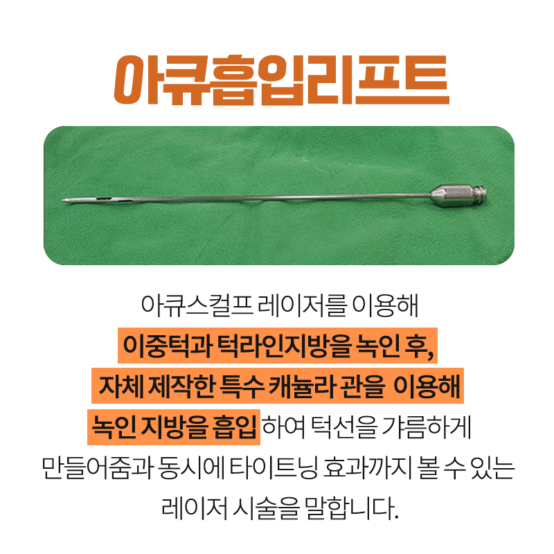 얼굴지방흡입전후 얼굴선이 또렷해지는 이유 관련 이미지 4