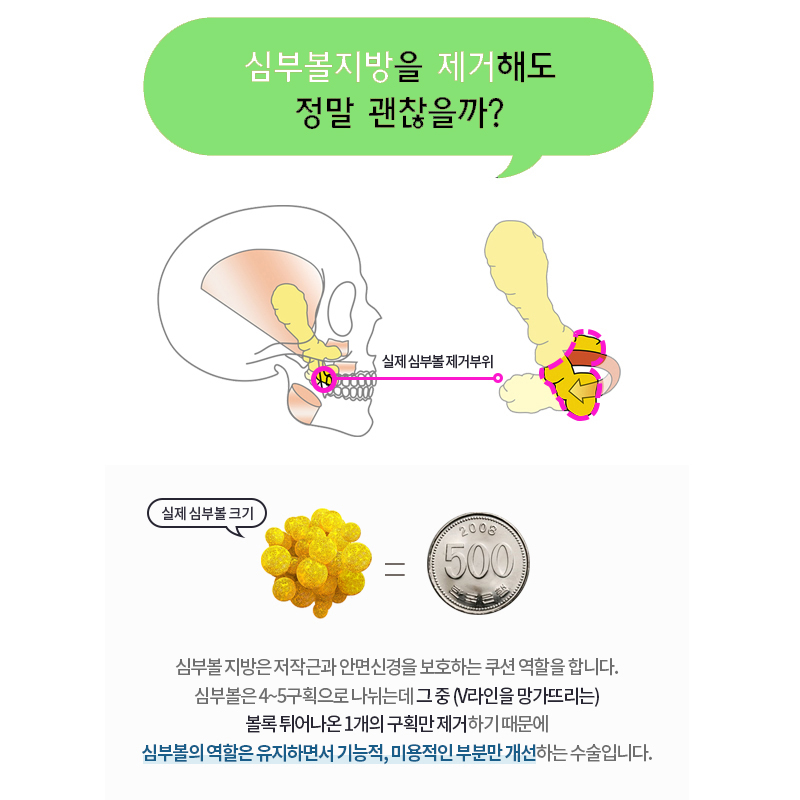 얼굴지방흡입전후 실력 좋은 원장님 계신 곳에서 관련 이미지 5