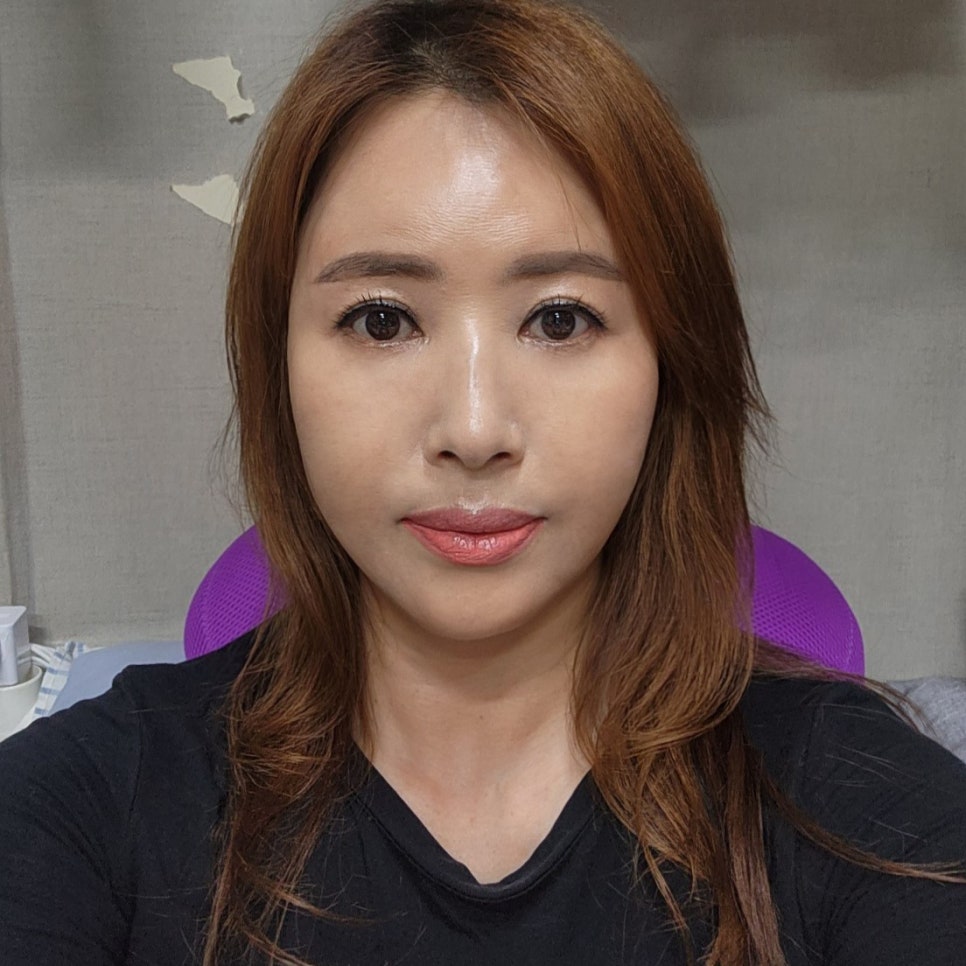 중년눈밑처짐 잃어버린 10년 찾아드렸어요! 관련 이미지 1
