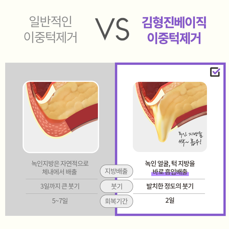 이중턱제거후기 턱선이 예뻐야 얼굴형이 예뻐요! 관련 이미지 4