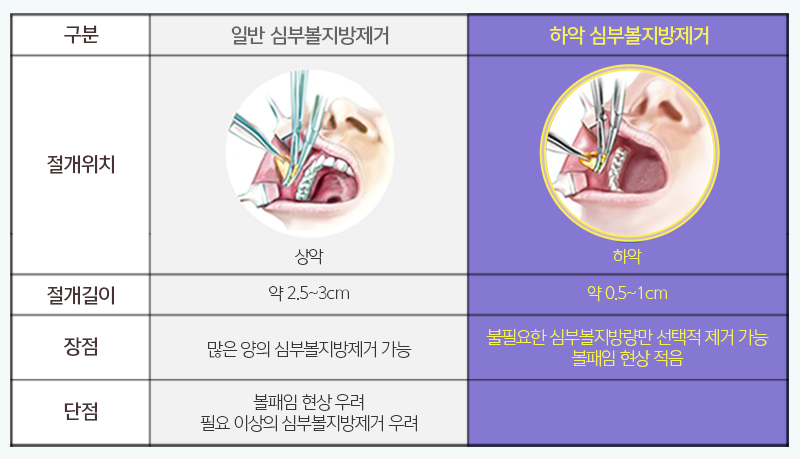 심부볼패임 무조건 온다고? 관련 이미지 5