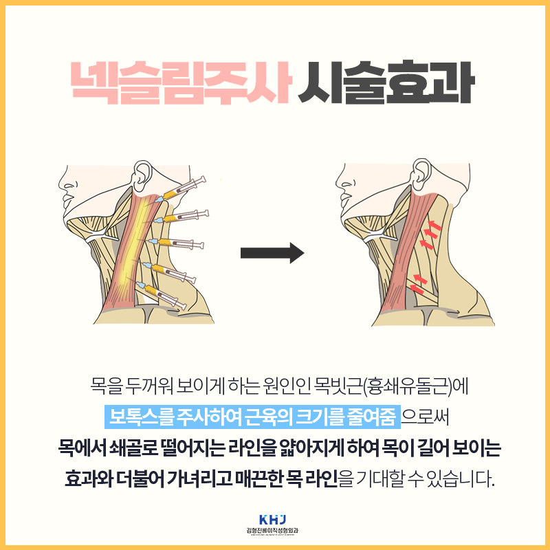 넥슬림주사후기 원조는 다르네요 관련 이미지 4