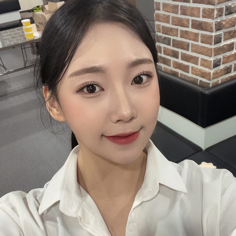 입꼬리필러붓기 별 거 아니죠! 관련 이미지 3