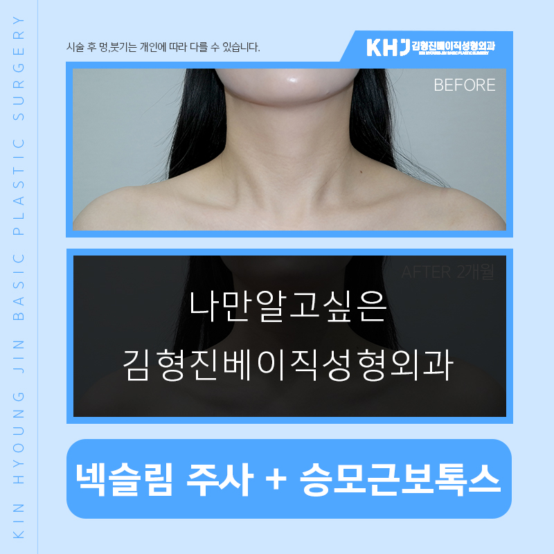 넥슬림주사효과 극대화 시키고 싶다면 관련 이미지 4