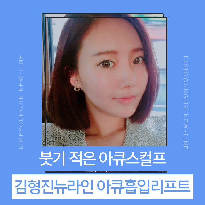 아큐스컬프 붓기 때문에 고민? 관련 이미지 1