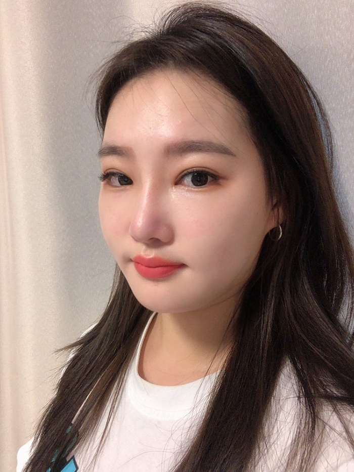 연예인얼굴지방흡입병원 여긴지 몰랐어요? 관련 이미지 1